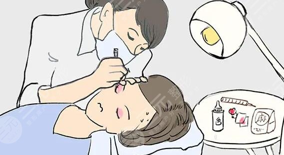 美瞳线一到七天恢复图，网友：别太急着跟潮流，多了解清楚对你有好处！