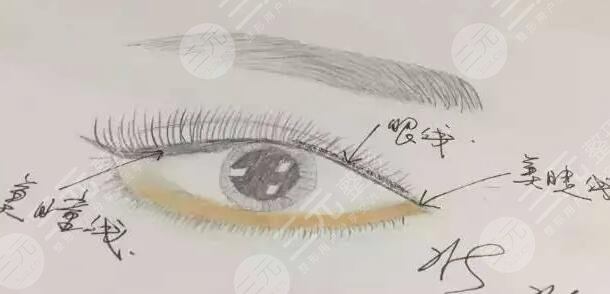 美瞳线手术术前