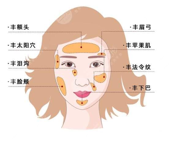 脂肪填充全脸有什么优点?