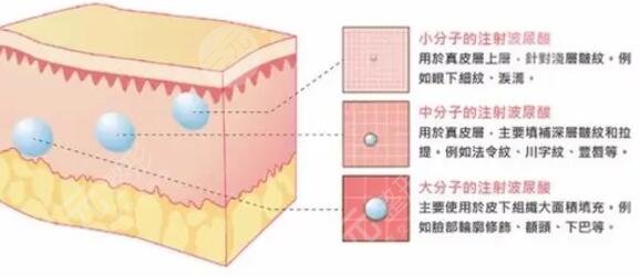 艾莉薇