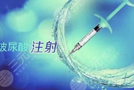 艾莉薇
