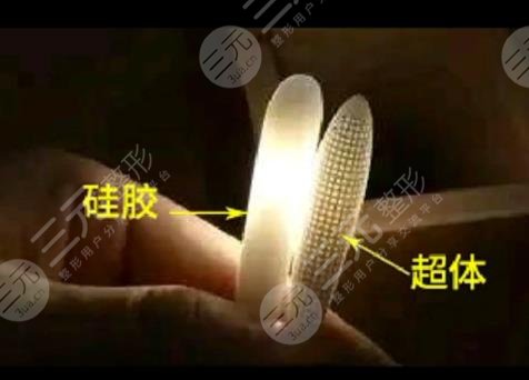 超体鼻假体