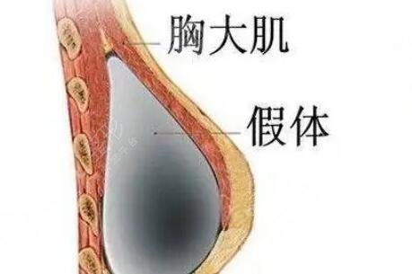 法芮娅ms