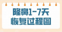 隆鼻1-7天恢复过程图是什么样子?真实隆鼻手术过程经历分享!附价格 隆鼻1-7天恢复过程图是什么样子?真实隆鼻手术过程经历分享!附价格
