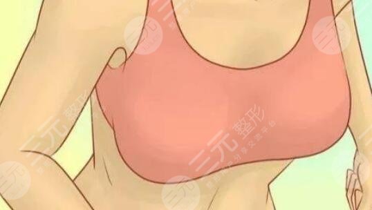 隆胸