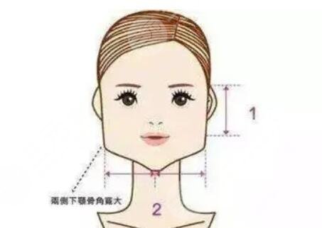 下颌缘吸脂