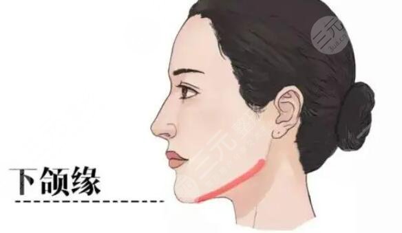 热玛吉下颌缘紧致提升