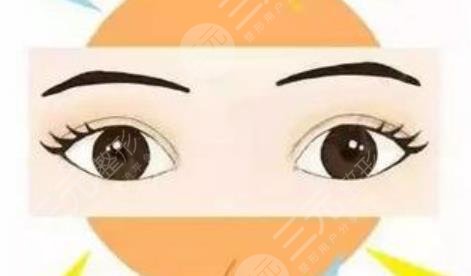 双眼皮