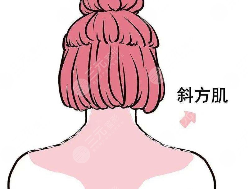 吸脂