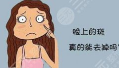 杭州全脸激光多少钱？新价格参考！光电美肤指南分享！