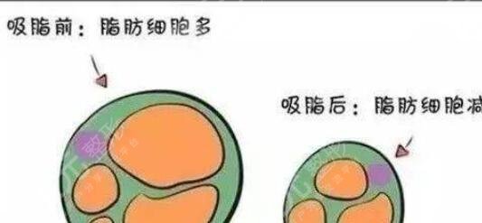 手臂