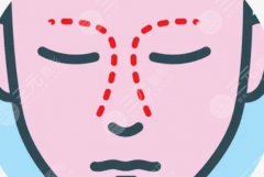 北京肋骨鼻子大概多少钱，哪里好？分享2家口碑医院及价格，必备干货！