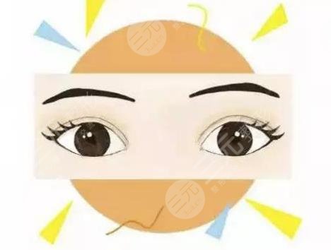 乐山武警医院做双眼皮手术果案例分享
