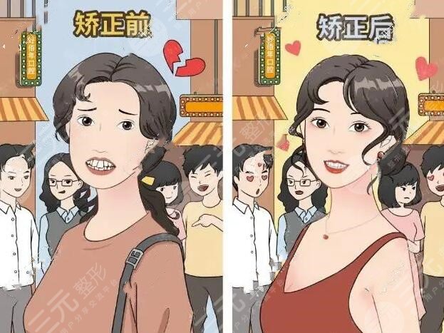 泸州口腔医院牙齿矫正案例