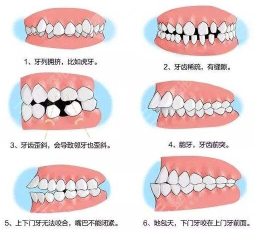 广州军区总医院口腔科牙齿矫正案例