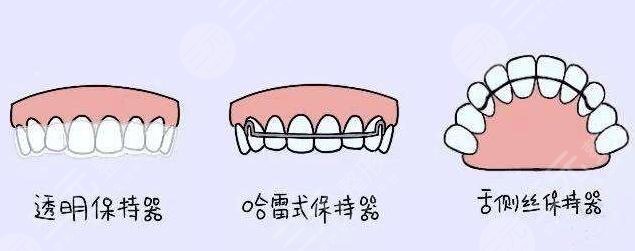 广州华侨医院口腔科牙齿矫正案例