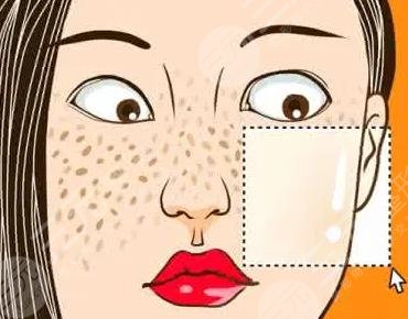 哪些方法可以祛斑