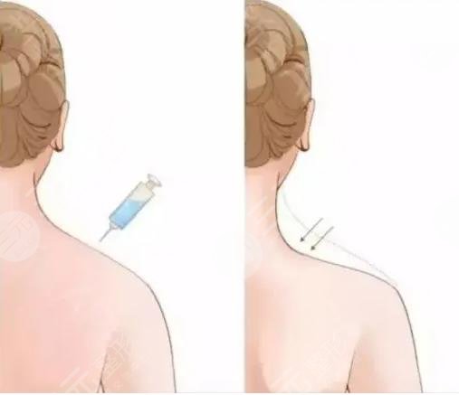 有什么危害和副作用