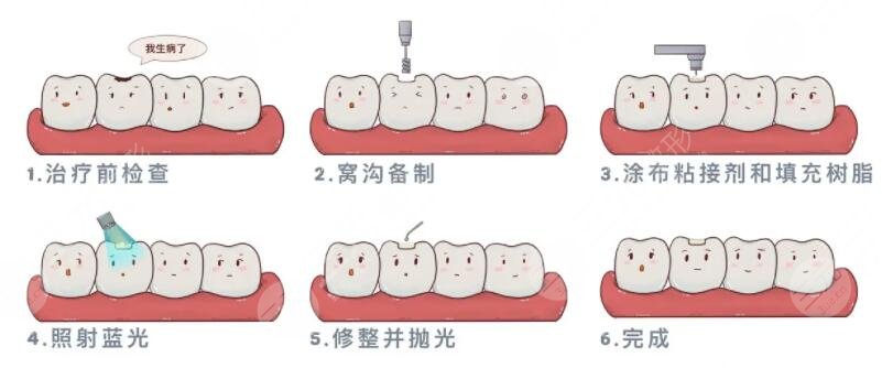 镶牙的使用寿命是多久?