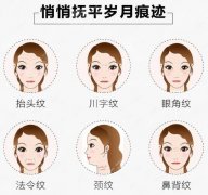 注射瘦脸一针多少钱