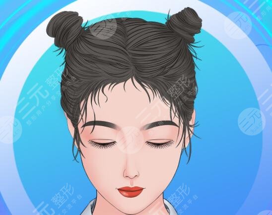 植发1000个毛囊单位图片,植发术后恢复过程记录,秃头星人有救啦!