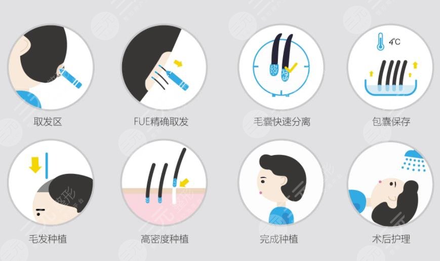 植发500单位有多大面积?