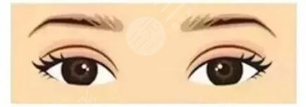 割双眼皮大概要多少钱？这3大原因直接影响了价格高低，小白必看！