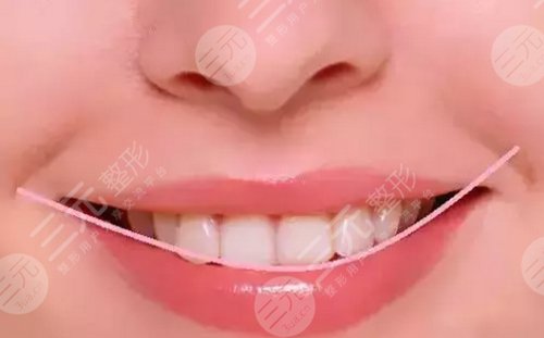 牙齿美容