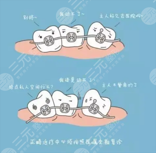 龅牙