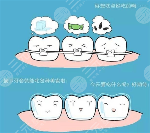 牙齿矫正