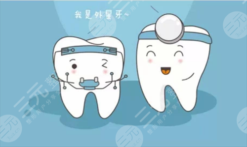 自锁托槽价格多少