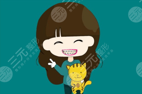 影响自锁托槽价格因素