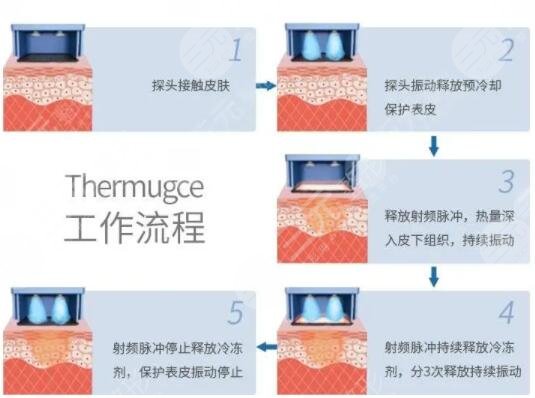 赛诺秀5D果可以维持多久？