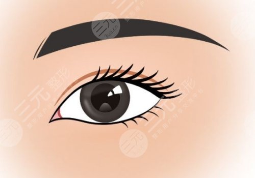 激光手术有哪些注意事项?