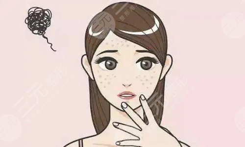 激光祛斑会反弹吗？多久能恢复正常皮肤？