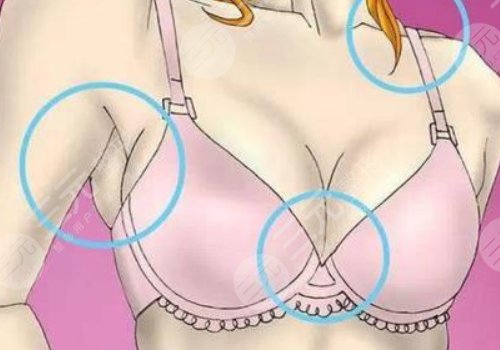 隆胸手术要多久后才能过正常生活?