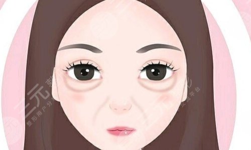 超声法去眼袋果怎么样？去眼袋注意事项有哪些？