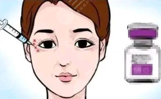 眼部皱纹打有用吗?吗?