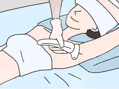 激光脱毛6年后后悔的原因