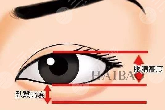 卧蚕眼有哪些手术方式 卧蚕眼的果怎么样