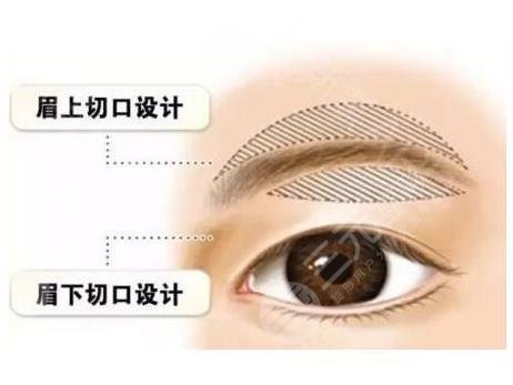 绣眉一般要多少钱 绣眉前后对比图