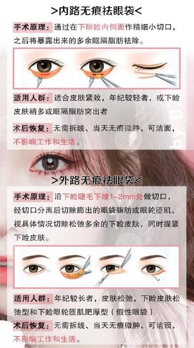 怎么样快速有缓解严重的眼袋和黑眼圈 去除黑眼圈和眼袋的喜欢办法