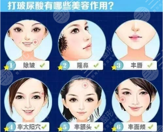 玻尿酸丰苹果肌有没有副作用? 玻尿酸丰苹果肌有没有副作用?