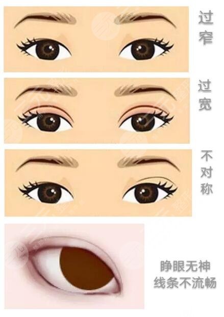 老年人还能眼部整形吗?需谨慎!