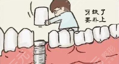 种植牙项目注意事项