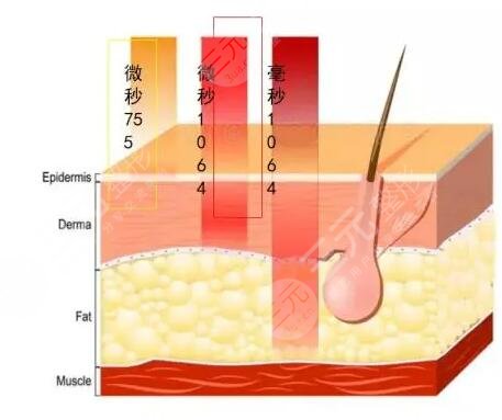 赛诺秀5d胶原光的术后注意事项：