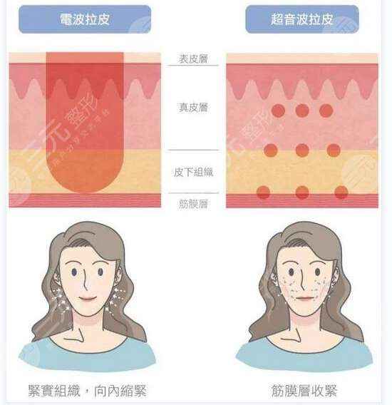 非面b提升手术的价格大盘点一览