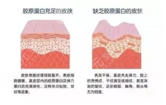 胶原蛋白丰苹果肌果好不好