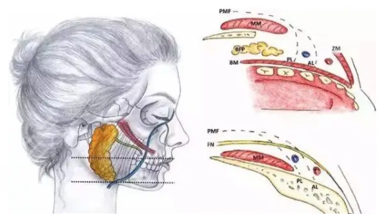 取颊脂垫对比图