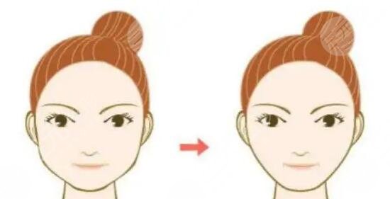 瘦脸大法好|颧骨颧弓整形多少钱？果对比